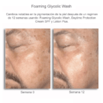 Foaming Glycolic Wash