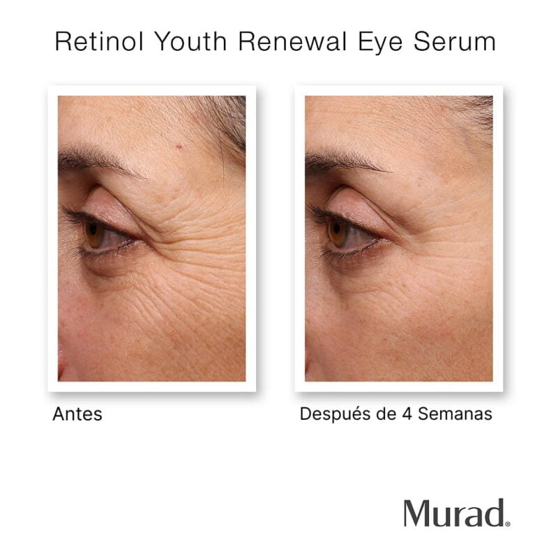 Retinol Youth Renewal Eye Serum