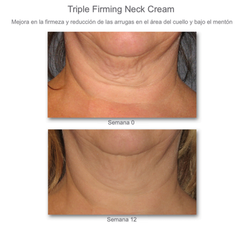 Triple Firming Neck Cream