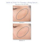 Tri-Therapy Lifting Serum