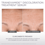 TranEXamide Discoloration Treatment Serum