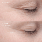 EGF Eye Serum